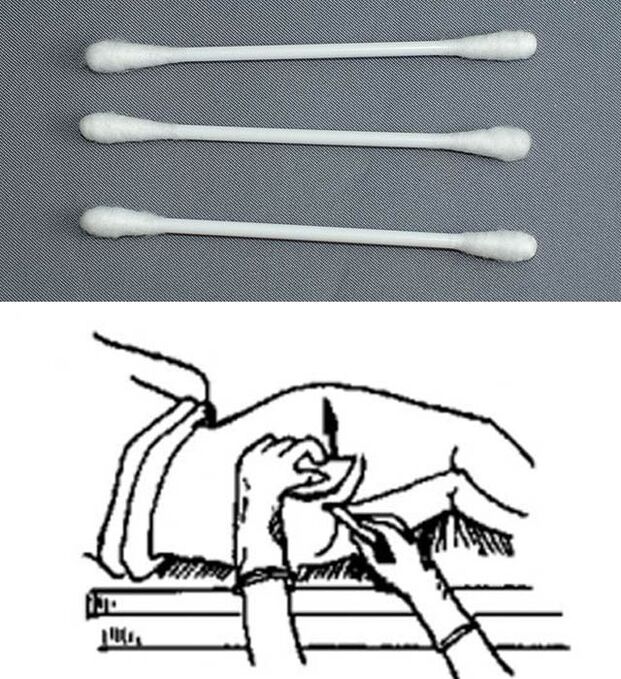 Palos de análisis