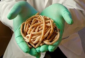 Cómo caen los gusanos en el cuerpo humano