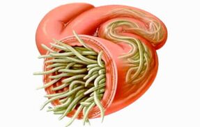 Cómo limpiar los intestinos de los parásitos
