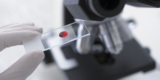 análisis de sangre para diagnosticar parásitos en el cuerpo