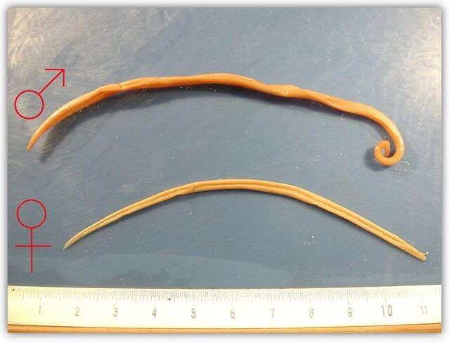 cómo se ven los gusanos redondos