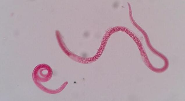 ¿Cómo se ve la triquinella