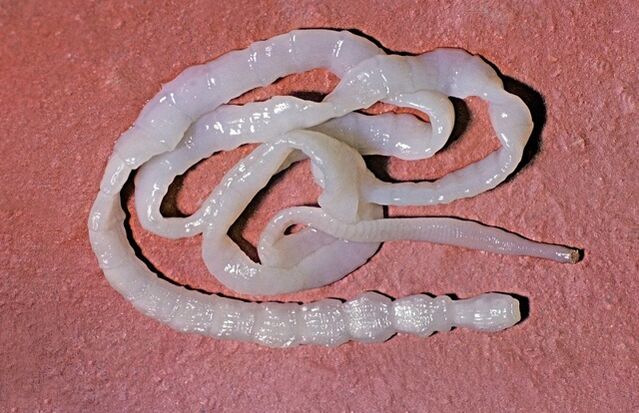 ¿Cómo se ve una tenia de toro